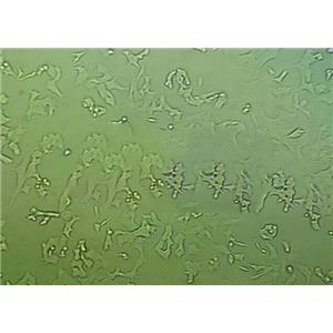 OVCA429 Cells#人卵巢癌細(xì)胞系低代次|培養(yǎng)基|贈STR圖譜