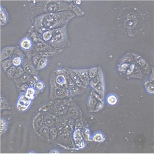 SUM159PT Cells#人乳腺癌細胞系低代次|培養(yǎng)基|贈STR圖譜