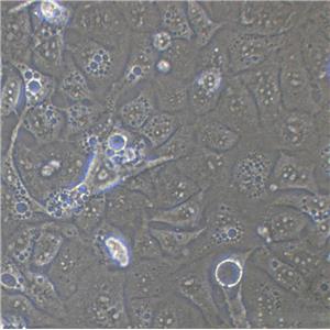 MM.1S Cells#人多發(fā)性骨髓瘤細胞系低代次|培養(yǎng)基|贈STR圖譜