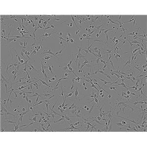 NCI-H2347 Cells#人肺癌細(xì)胞系低代次|培養(yǎng)基|贈(zèng)STR圖譜