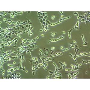 HCT 116 Cells#人结肠癌细胞系低代次|培养基|赠STR图谱