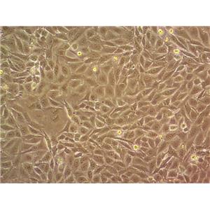 MDCK(NBL-2) Cells#犬腎細(xì)胞系來源可靠|培養(yǎng)基|帶STR基因圖譜