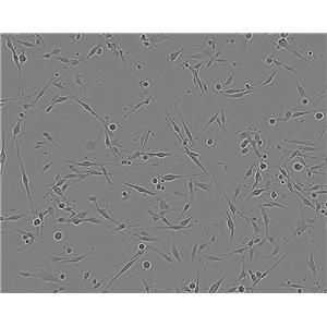 S3-HeLa Cells#人宮頸癌細胞系來源可靠|培養(yǎng)基|帶STR基因圖譜