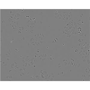 SUM 159 Cells#人乳腺癌細(xì)胞系來源可靠|培養(yǎng)基|帶STR基因圖譜,SUM 159 Cells#