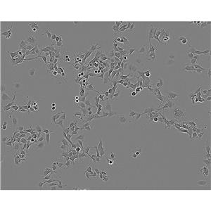 mda468 Cells#人乳腺癌细胞系来源可靠|培养基|带STR基因图谱