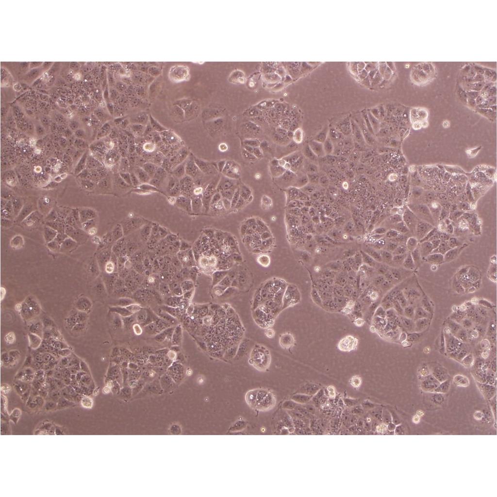 NCIH526 Cells#人肺癌细胞系来源可靠|培养基|带STR基因图谱,NCIH526 Cells#