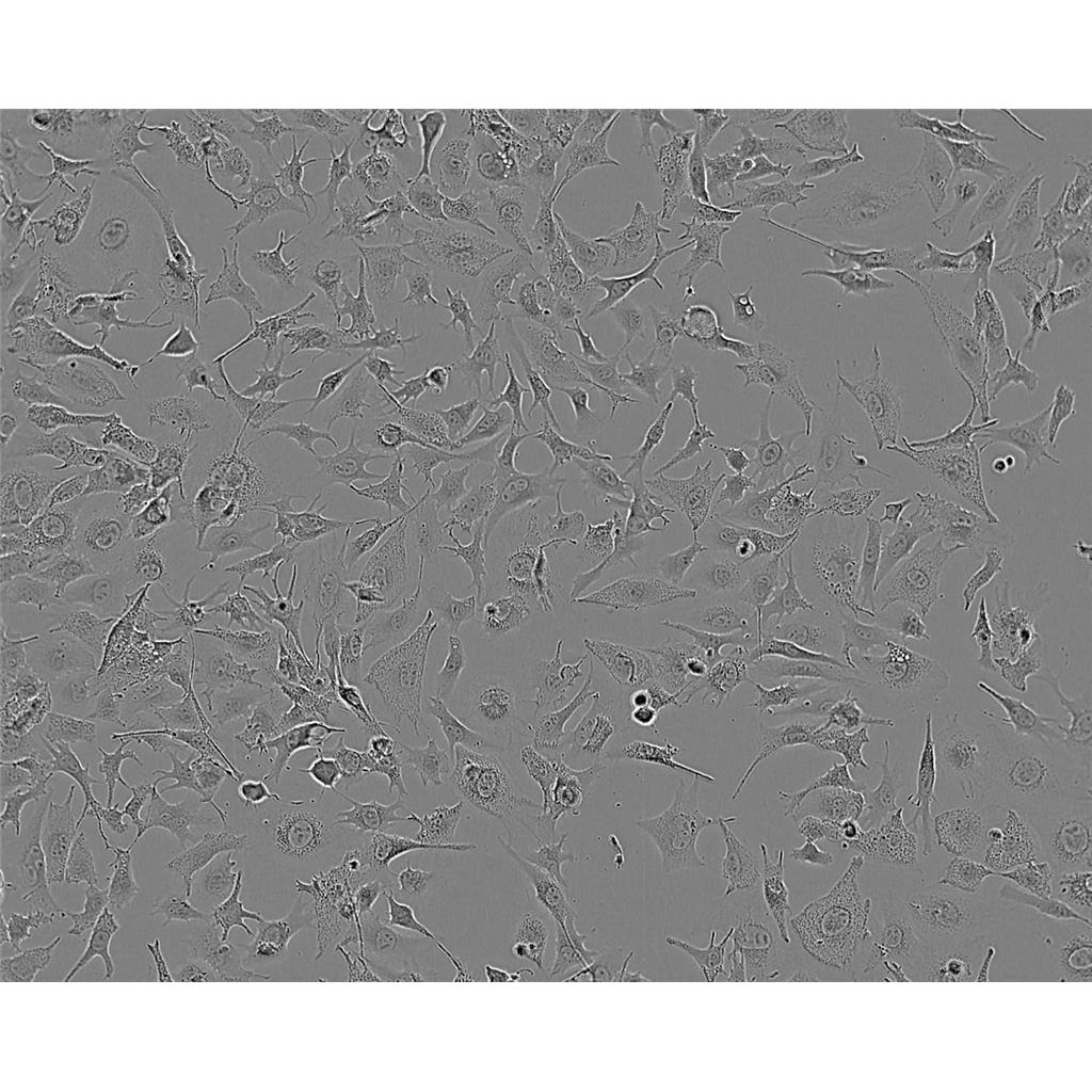 mdamB468 Cells#人乳腺癌細胞系來源可靠|培養(yǎng)基|帶STR基因圖譜,mdamB468 Cells#