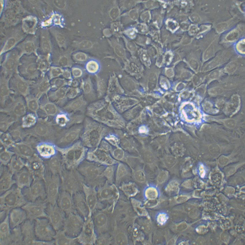 NCI-HUT-292 Cells#人肺腺癌細(xì)胞系來(lái)源可靠|培養(yǎng)基|帶STR基因圖譜,NCI-HUT-292 Cells#