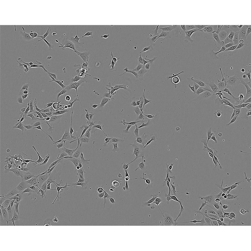 NCTC-929 Cells#小鼠成纖維細(xì)胞系來源可靠|培養(yǎng)基|帶STR基因圖譜,NCTC-929 Cells#