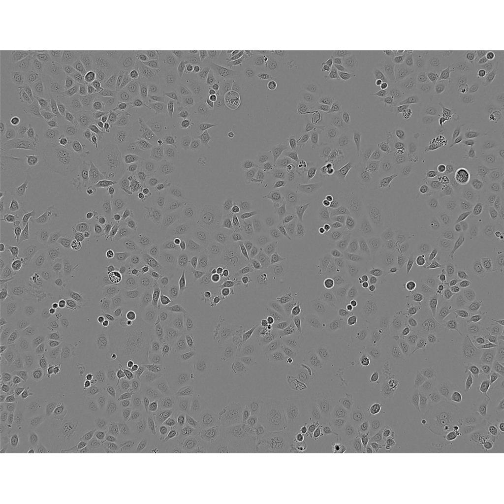 U-2OS Cells#人骨肉瘤細胞系來源可靠|培養(yǎng)基|帶STR基因圖譜,U-2OS Cells#