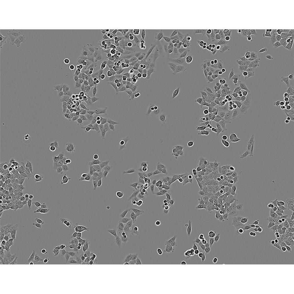 SK.OV.3 Cells#人卵巢癌細胞系來源可靠|培養(yǎng)基|帶STR基因圖譜,SK.OV.3 Cells#