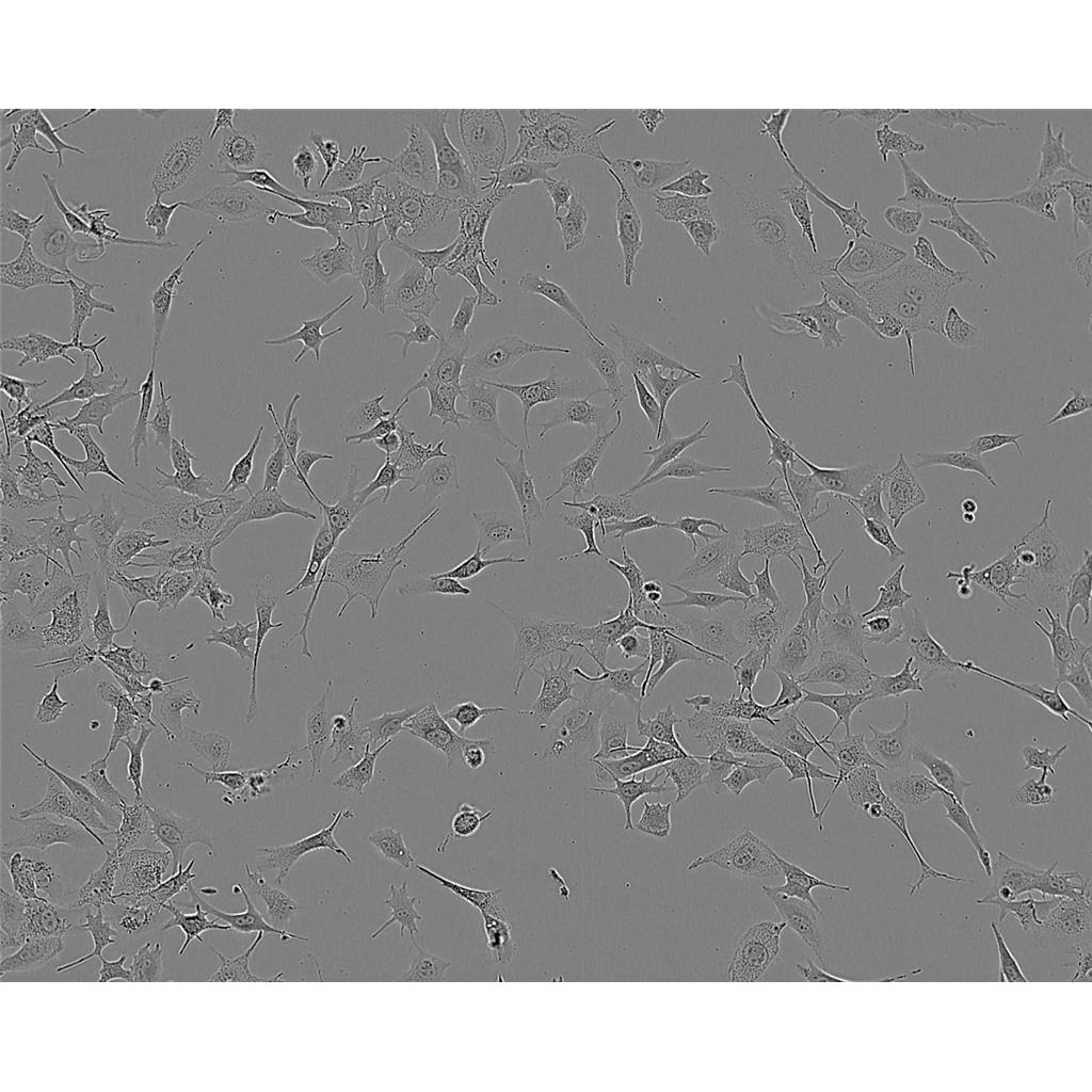 BNL CL2 Cells#小鼠胚胎肝細胞系來源可靠|培養(yǎng)基|帶STR基因圖譜,BNL CL2 Cells#