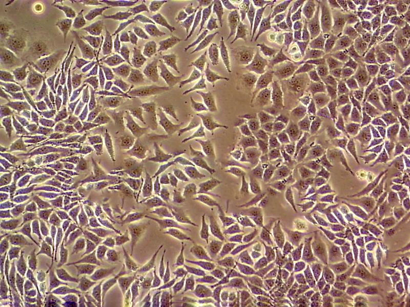 MCF.7 Cells#人乳腺癌細(xì)胞系來(lái)源可靠|培養(yǎng)基|帶STR基因圖譜,MCF.7 Cells#