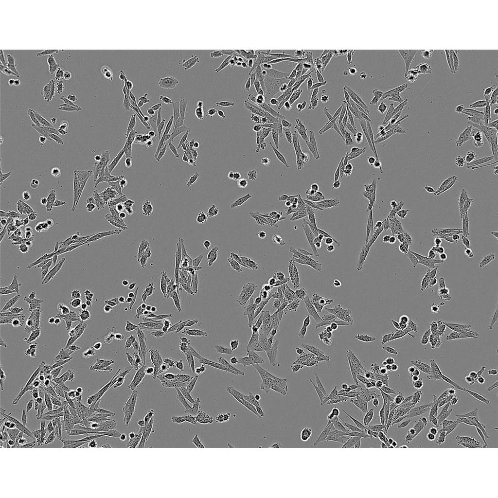 SW-780 Cells#人膀胱移行癌細胞系來源可靠|培養(yǎng)基|帶STR基因圖譜,SW-780 Cells#