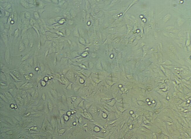 SNU-182 Cells#人肝癌细胞系来源可靠|培养基|带STR基因图谱,SNU-182 Cells#