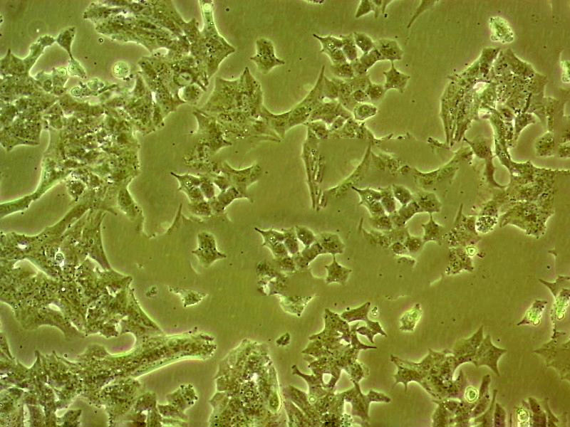 NCI-H446 Cells#人小細(xì)胞肺癌細(xì)胞系來源可靠|培養(yǎng)基|帶STR基因圖譜,NCI-H446 Cells#