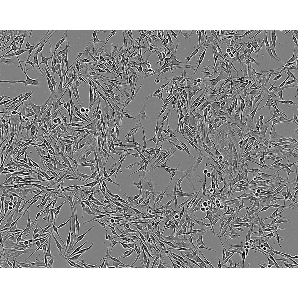 B16-F1 Cells#小鼠黑色素瘤細(xì)胞系來源可靠|培養(yǎng)基|帶STR基因圖譜,B16-F1 Cells#