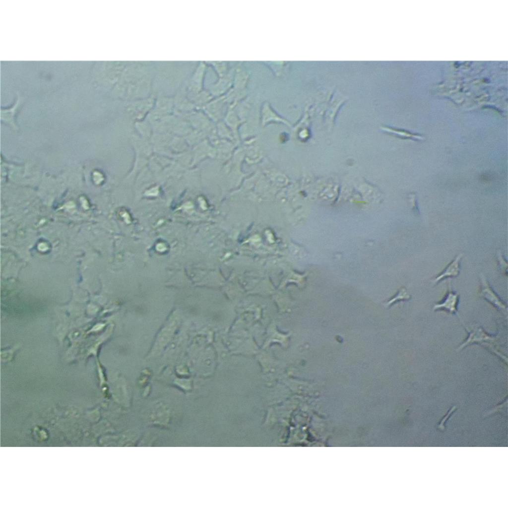 HCC1143 Cells#人乳腺癌細(xì)胞系來源可靠|培養(yǎng)基|帶STR基因圖譜,HCC1143 Cells#