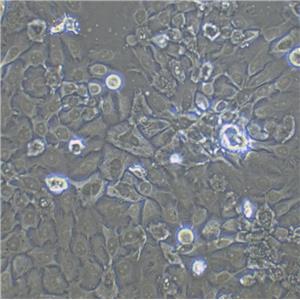 NCI-HUT-292 Cells#人肺腺癌細胞系來源可靠|培養(yǎng)基|帶STR基因圖譜