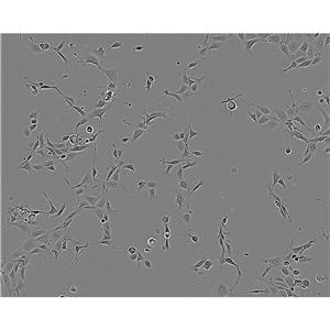 NCTC-929 Cells#小鼠成纖維細胞系來源可靠|培養(yǎng)基|帶STR基因圖譜