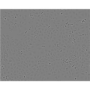 SW 780 Cells#人膀胱移行癌细胞系来源可靠|培养基|带STR基因图谱