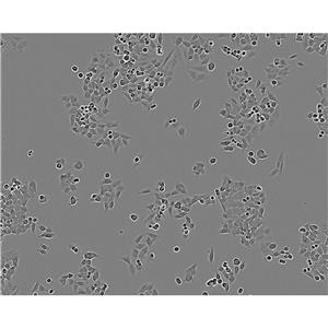 SK.OV.3 Cells#人卵巢癌細(xì)胞系來(lái)源可靠|培養(yǎng)基|帶STR基因圖譜