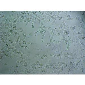 Eca109 Cells#人食管癌細(xì)胞系來源可靠|培養(yǎng)基|帶STR基因圖譜