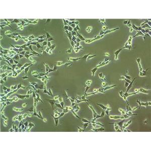 PLA801D Cells#人高转移肺癌细胞系来源可靠|培养基|带STR基因图谱