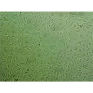 SW-620 Cells#人結(jié)腸癌細(xì)胞系來(lái)源可靠|培養(yǎng)基|帶STR基因圖譜