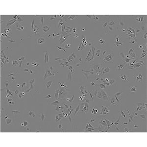 UMR-106 Cells#大鼠骨肉瘤細(xì)胞系來源可靠|培養(yǎng)基|帶STR基因圖譜