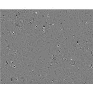 NCI-H1693 Cells#人肺腺癌細(xì)胞系來(lái)源可靠|培養(yǎng)基|帶STR基因圖譜