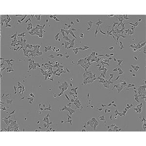 SW756 Cells#人子宮鱗狀癌細(xì)胞系來源可靠|培養(yǎng)基|帶STR基因圖譜