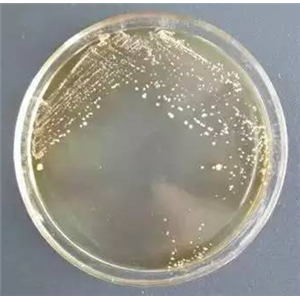 Mucor Circinelloides F. Janssenii,Mucor Circinelloides F. Janssenii