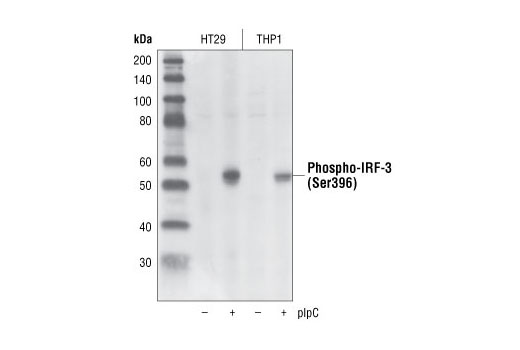 抗磷酸化IRF-3（Ser396）兔單克隆抗體,Phospho-IRF-3 (Ser396) (4D4G) Rabbit mAb