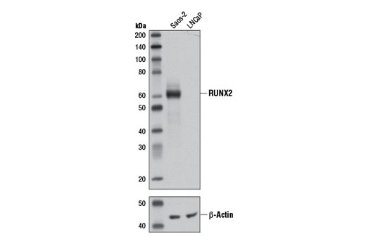 RUNX2 (D1L7F) 兔單克隆抗體,RUNX2 (D1L7F) Rabbit mAb