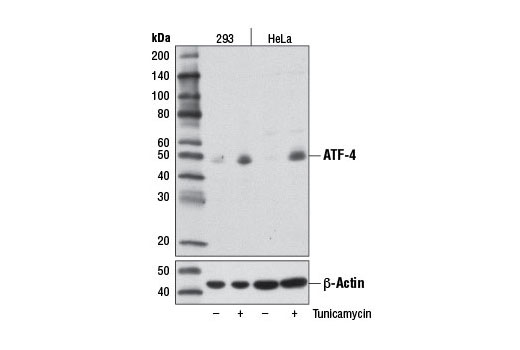 ATF-4 (D4B8) 兔單克隆抗體,ATF-4 (D4B8) Rabbit mAb