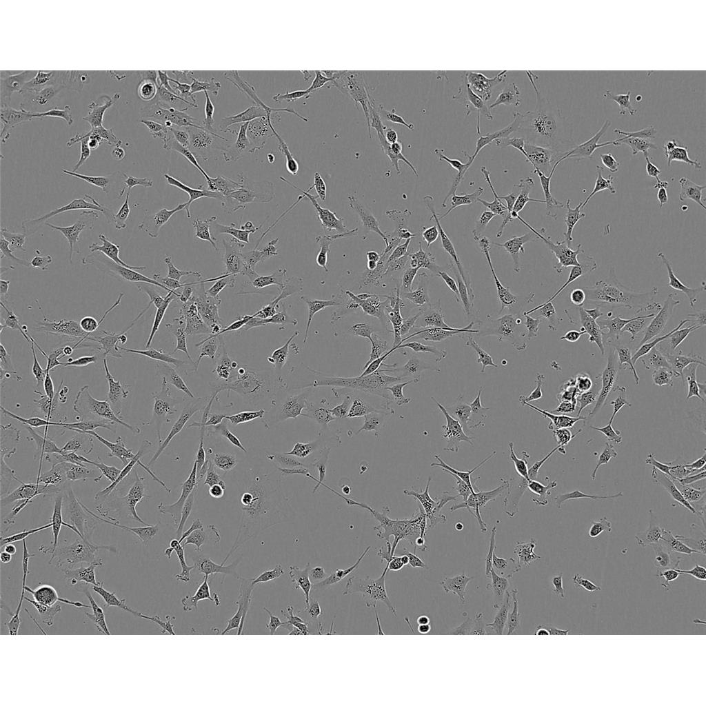 放線菌分離瓊脂培養(yǎng)基[源頭供貨],Actinomycete Isolation