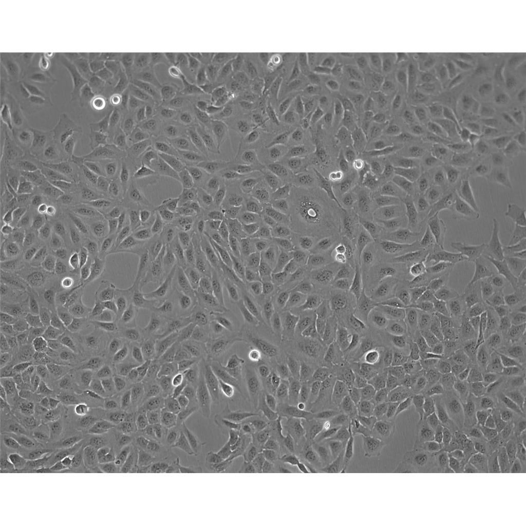 TCCSUP Cells#人膀胱癌細(xì)胞系來(lái)源可靠|培養(yǎng)基|帶STR基因圖譜,TCCSUP Cells#