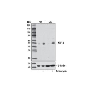 ATF-4 (D4B8) 兔單克隆抗體,ATF-4 (D4B8) Rabbit mAb