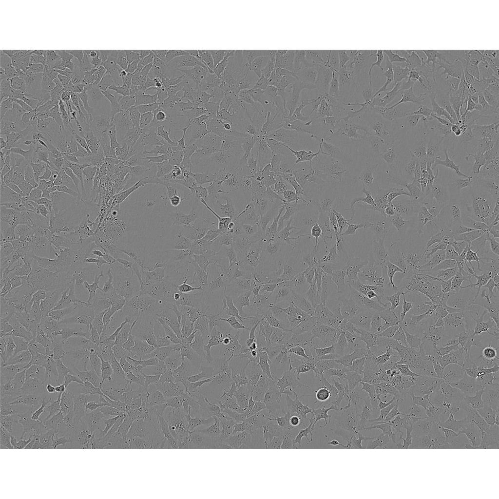 KM2豬肺炎支原體肉湯培養(yǎng)基[源頭供貨],KM2 Mycoplasma Hyopneumoniae Broth Medium