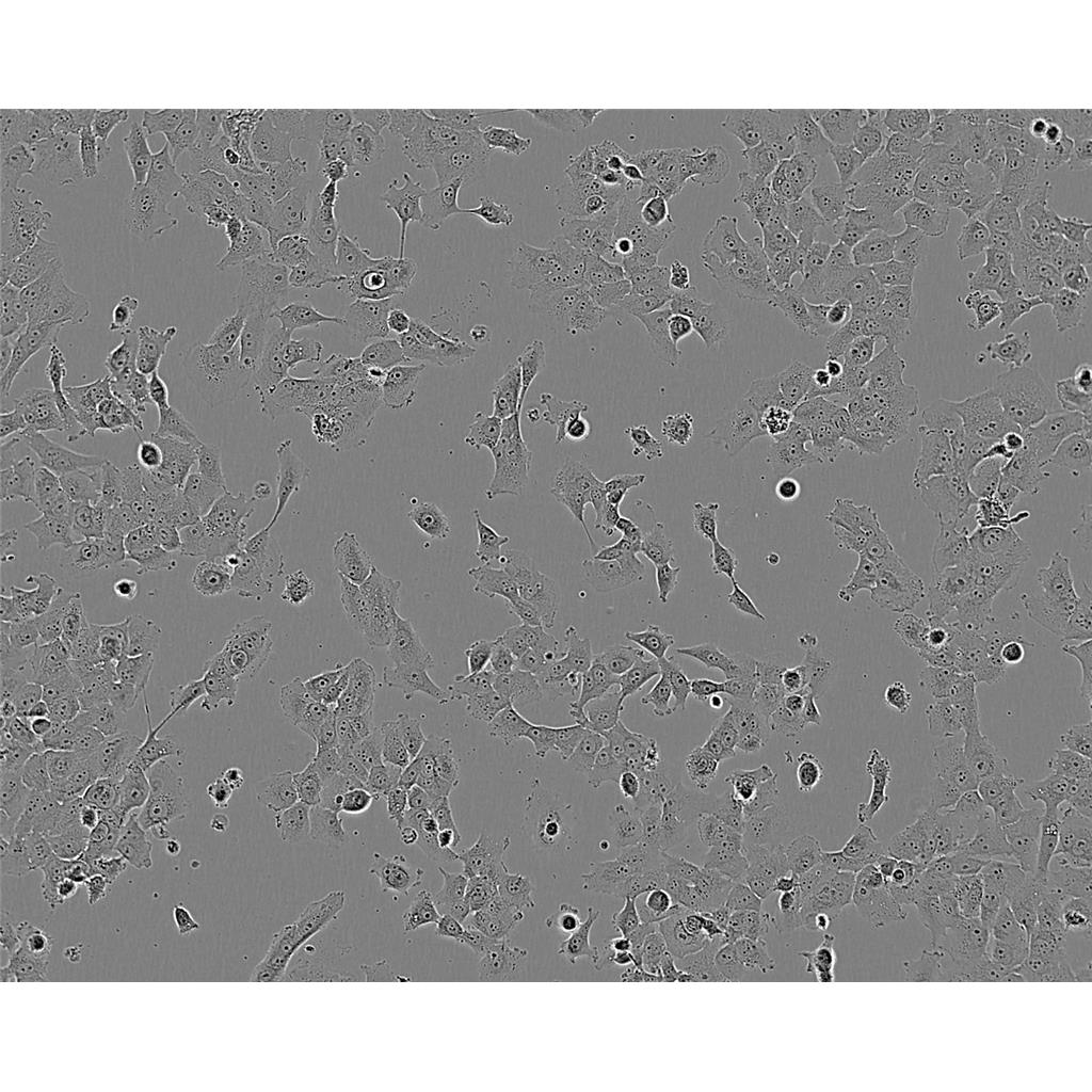 Hep 3B Cells#人肝癌細(xì)胞系復(fù)蘇中心|完全培養(yǎng)基|STR圖譜,Hep 3B Cells#