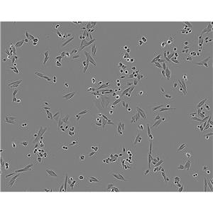 Uhth-7 Cells#人甲状腺癌细胞系复苏中心|完全培养基|STR图谱