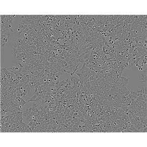 Sarcoma 180 Cells#小鼠腹水瘤細(xì)胞系復(fù)蘇中心|完全培養(yǎng)基|STR圖譜