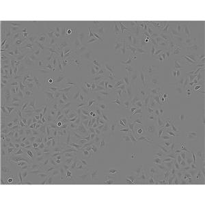 X63-Ag8 Cells#小鼠骨髓瘤細(xì)胞系復(fù)蘇中心|完全培養(yǎng)基|STR圖譜