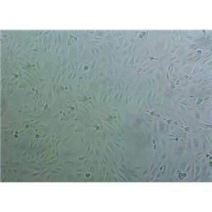 HPAF-II/CD18 Cells#人胰腺癌細(xì)胞系復(fù)蘇中心|完全培養(yǎng)基|STR圖譜