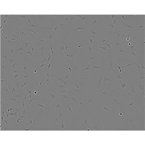 HeLa S 3 Cells#人宮頸癌細(xì)胞系復(fù)蘇中心|完全培養(yǎng)基|STR圖譜