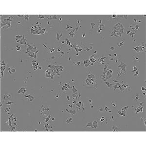 mda-175 Cells#人乳腺導(dǎo)管癌細(xì)胞系復(fù)蘇中心|完全培養(yǎng)基|STR圖譜