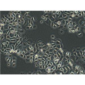U20-S Cells#人骨肉瘤細(xì)胞系復(fù)蘇中心|完全培養(yǎng)基|STR圖譜