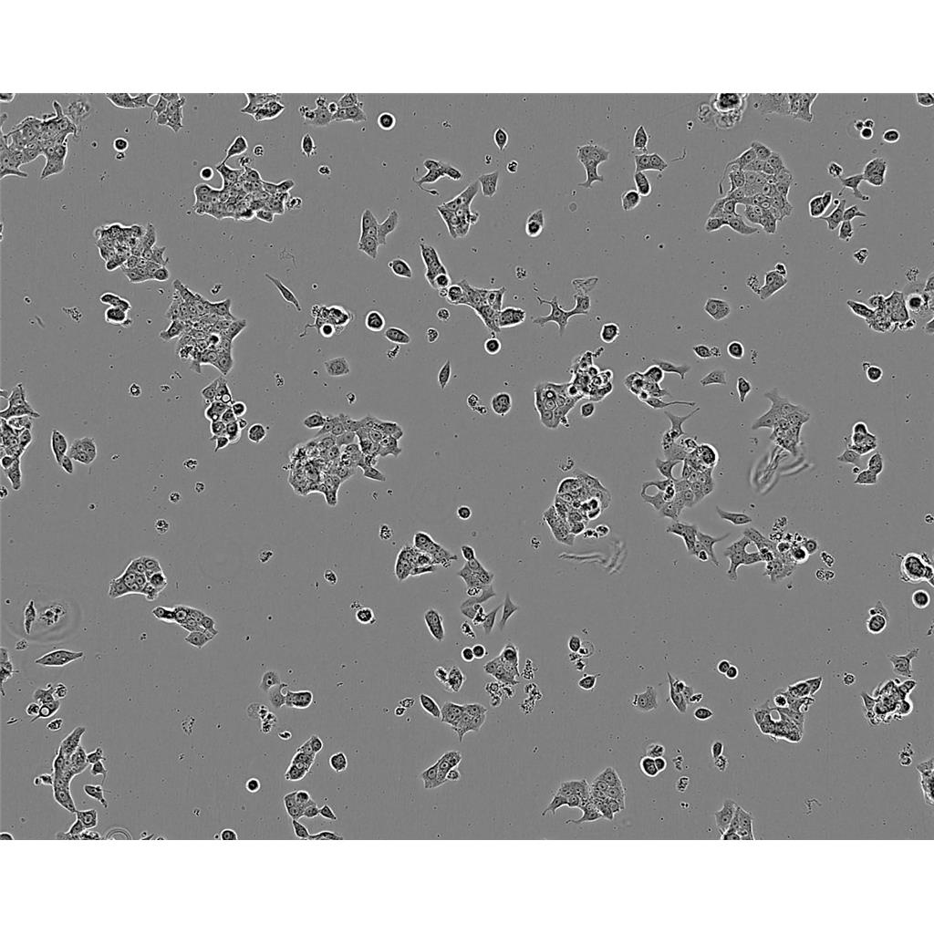 NCIH526 Cells#人肺癌細(xì)胞系復(fù)蘇中心|完全培養(yǎng)基|STR圖譜,NCIH526 Cells#