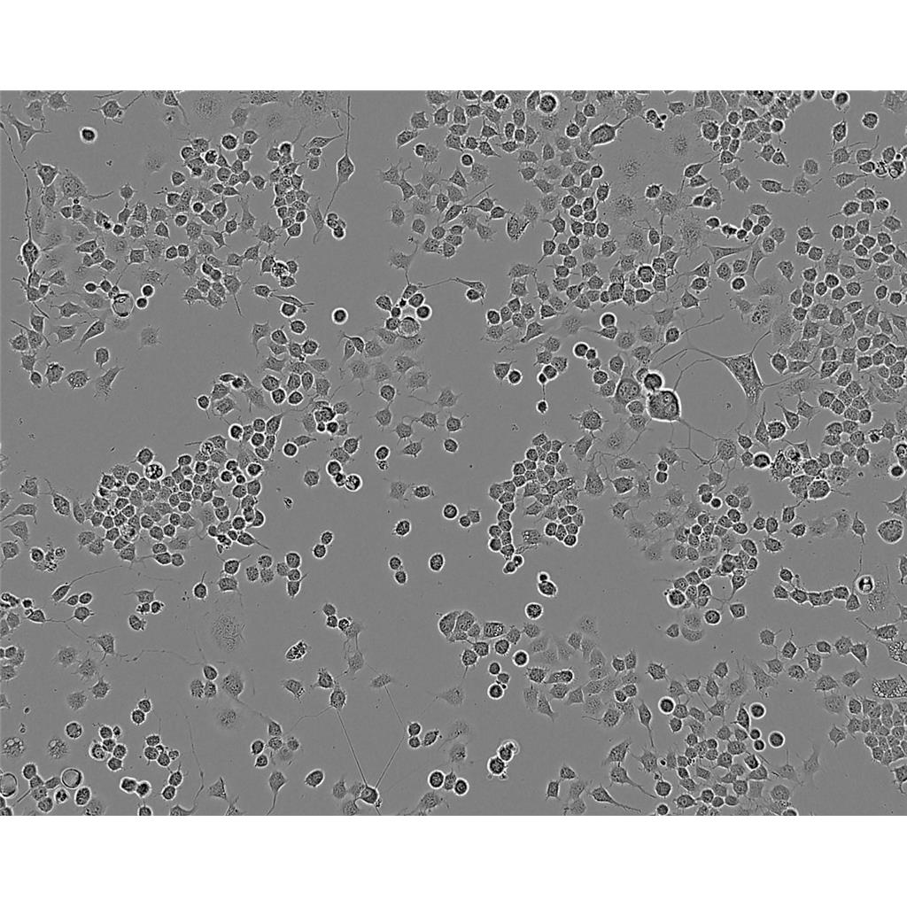 Bx-PC3 Cells#人原位胰腺腺癌細胞系復(fù)蘇中心|完全培養(yǎng)基|STR圖譜,Bx-PC3 Cells#